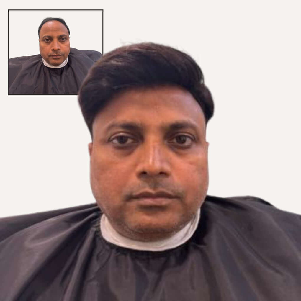 Premium Australian Hair Patch (A+ Quality)